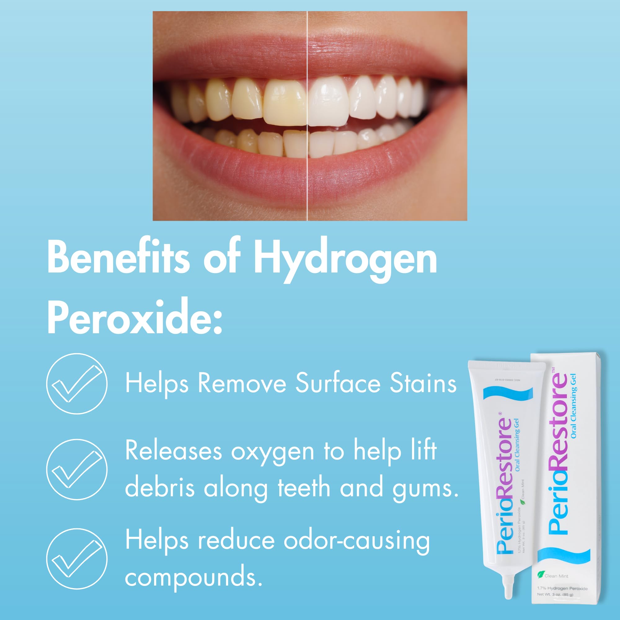 Rotadent Procare gel and tray ready for daily use
