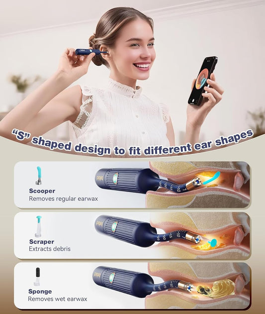 RSRNKXC HD ear cleaner real-time view for safer cleaning.
