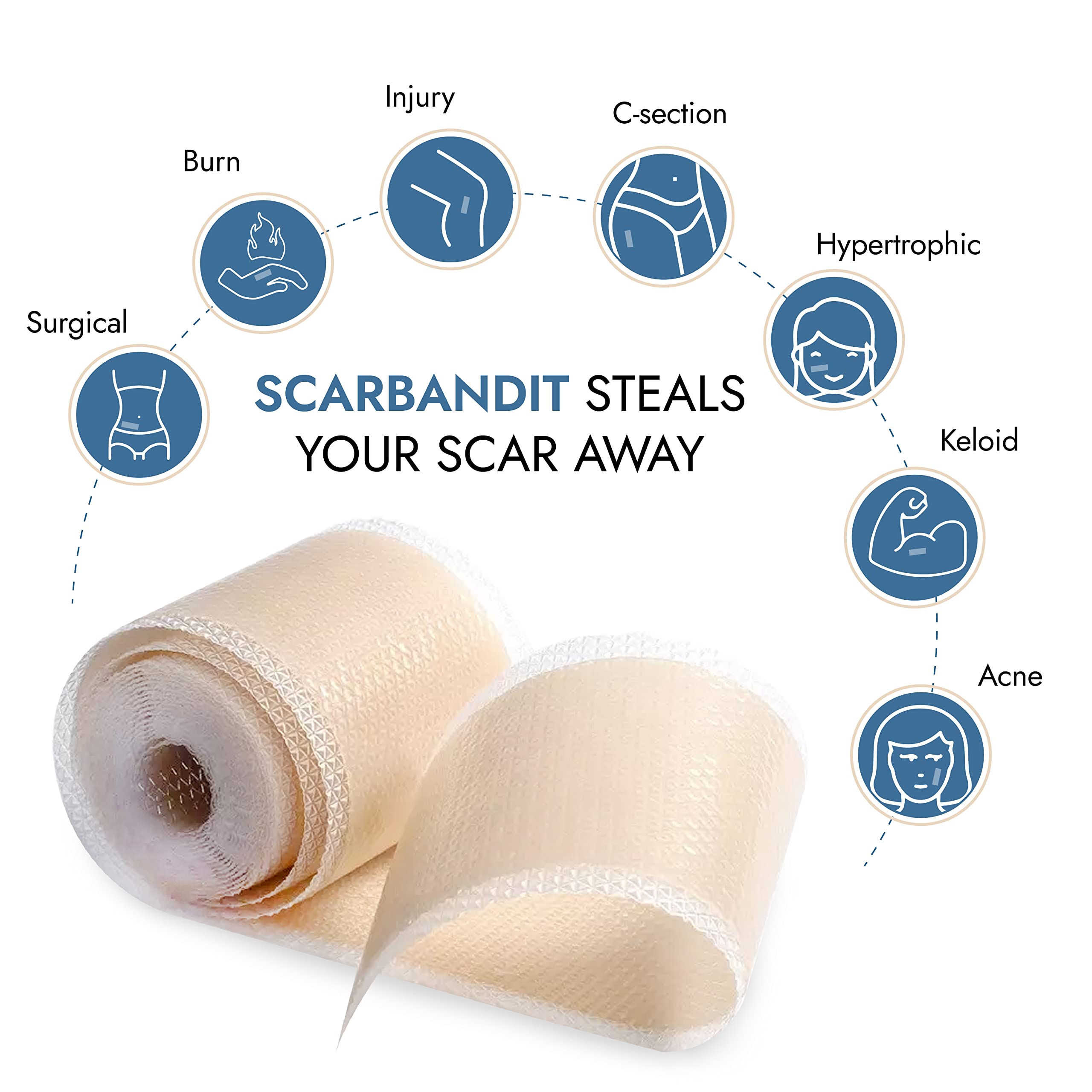 Scarbandit silicone scar tape on skin helps flatten and soften scars over time