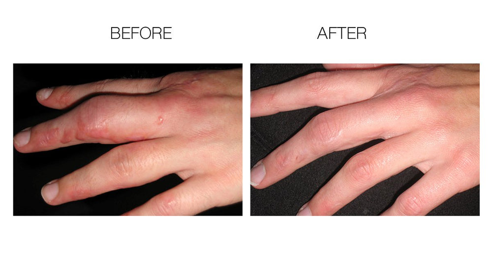 ScarFade box packaging highlights 30g silicone scar gel for home use.
