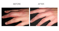ScarFade box packaging highlights 30g silicone scar gel for home use.