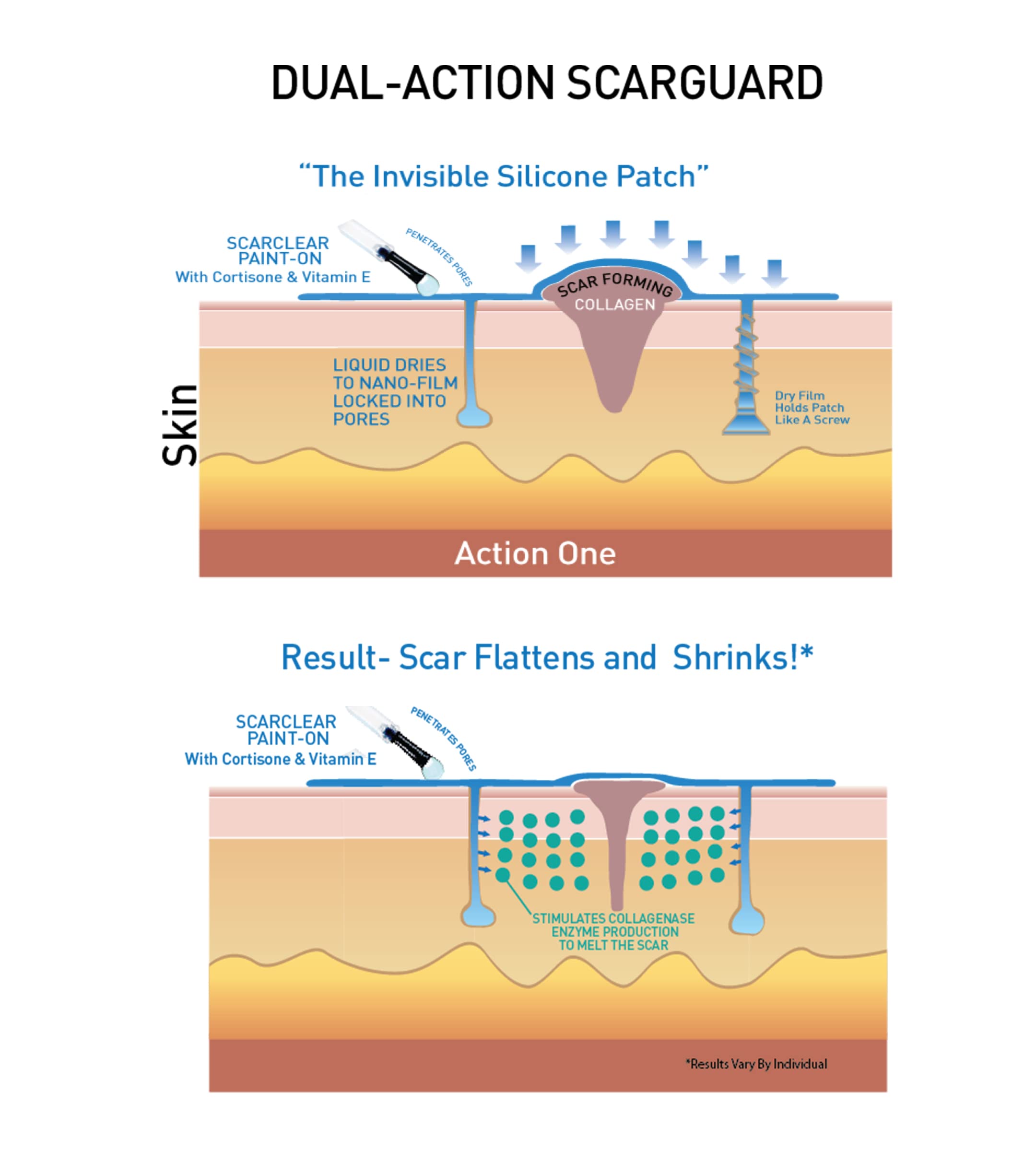 ScarGuard after-wound application may help minimize new scar formation.