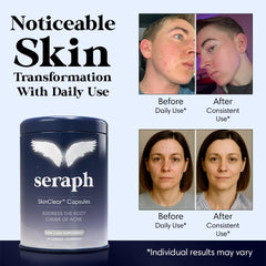 Seraph acne supplement bottle back label, detailing clean ingredients.