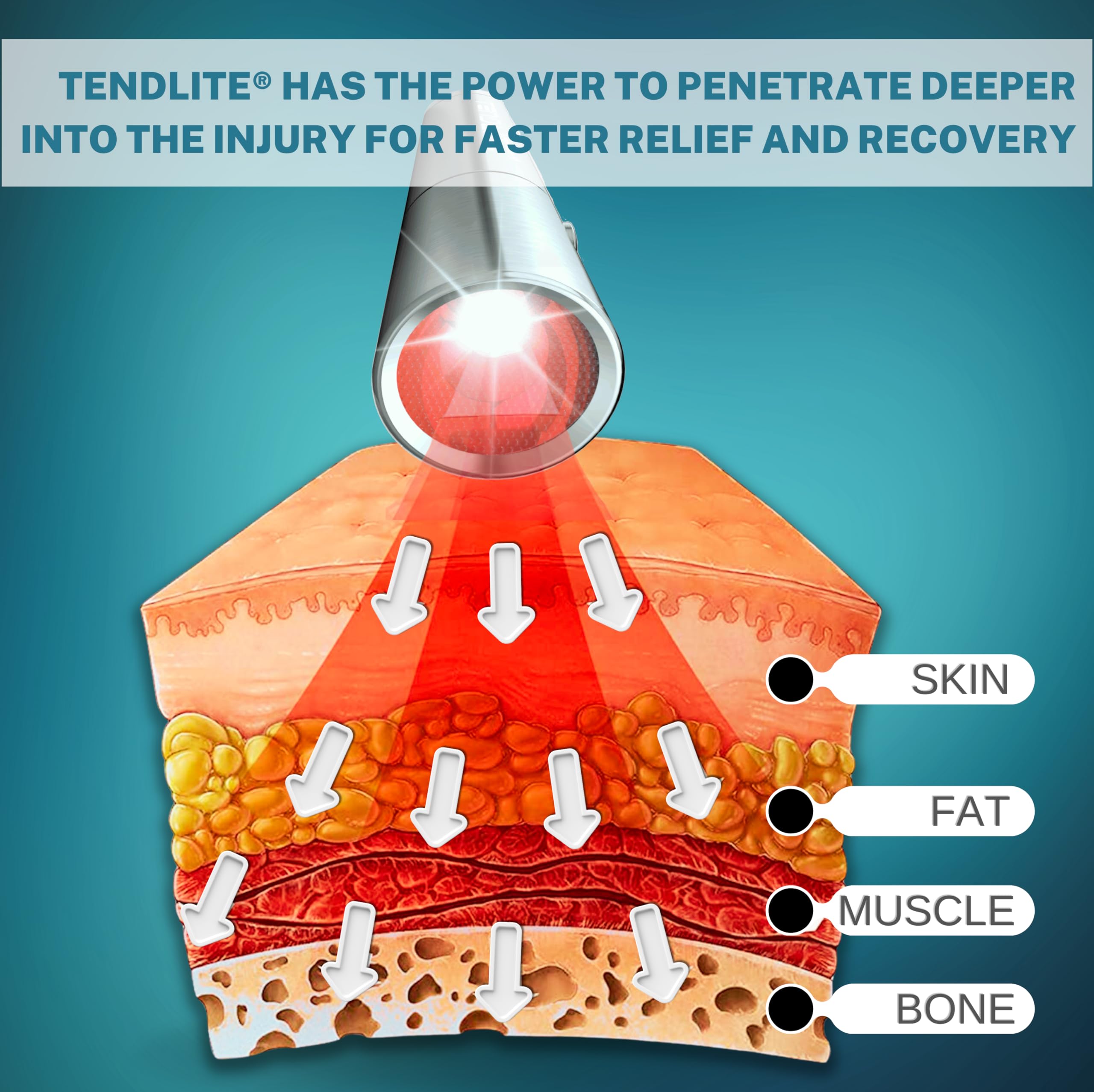SHINE Deep Red Tendlite in a short 1-minute dosing session