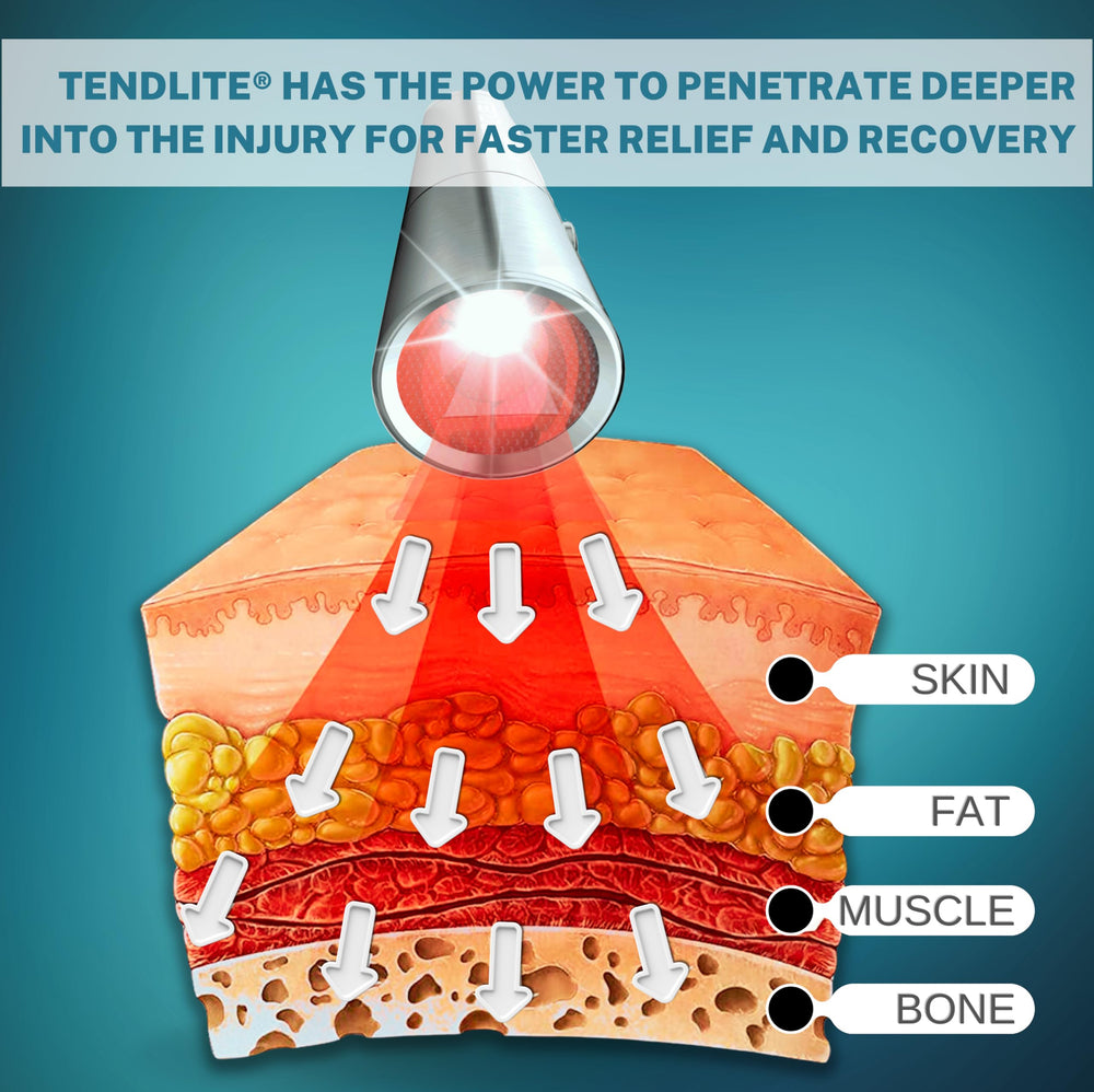 SHINE Deep Red Tendlite in a short 1-minute dosing session