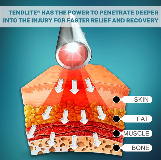 SHINE Deep Red Tendlite in a short 1-minute dosing session