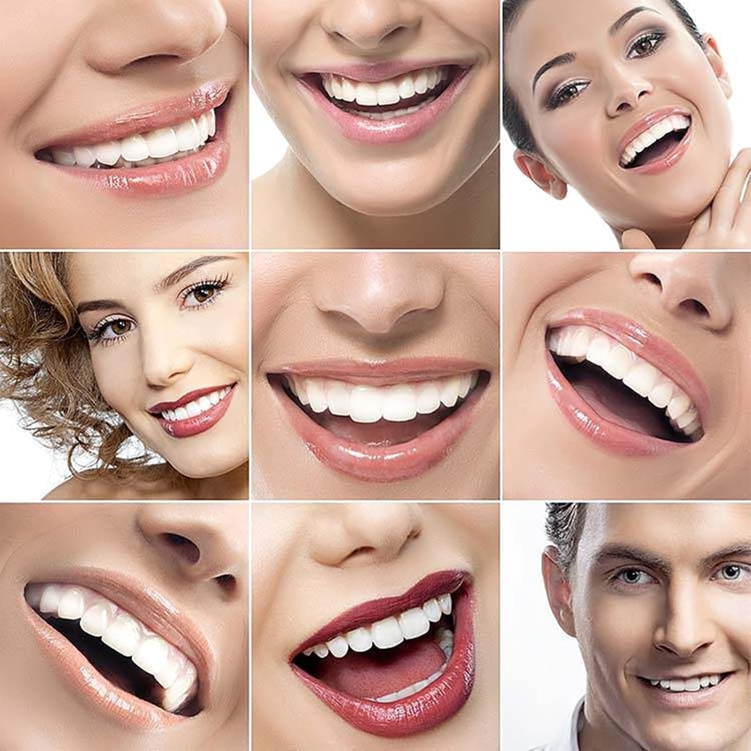 Shiny Smile veneers provide a natural-color finish for a believable smile.