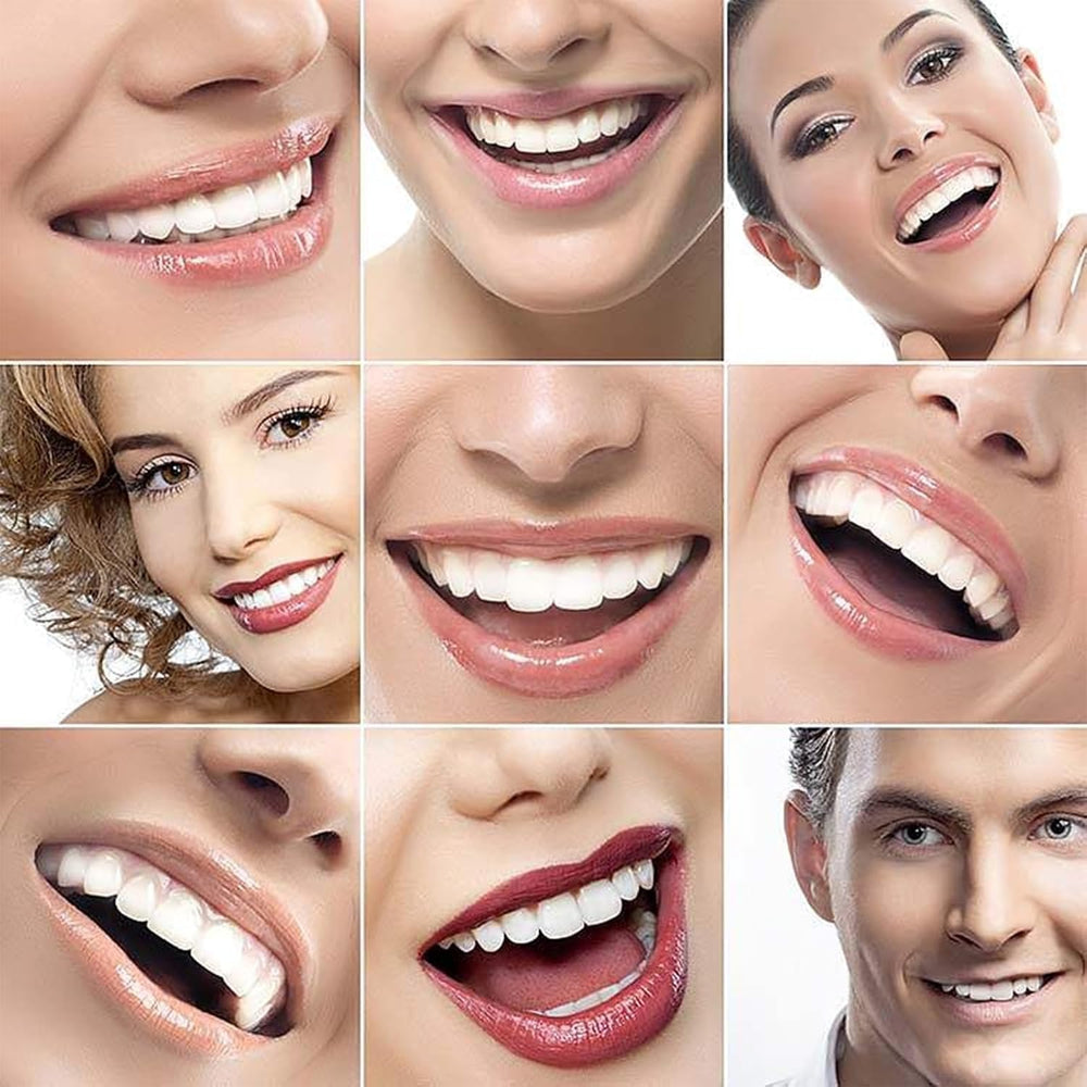Shiny Smile veneers provide a natural-color finish for a believable smile.