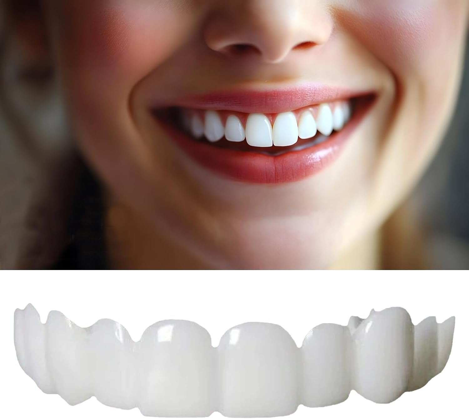 Shiny Smile veneers show a one-size-fit design for versatile smiles.