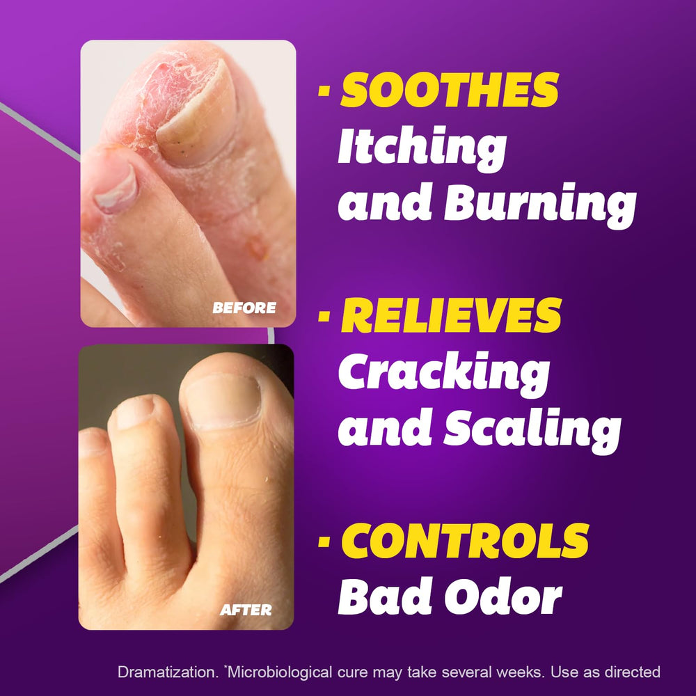 Silka 1% terbinafine label indicates powerful antifungal formula.