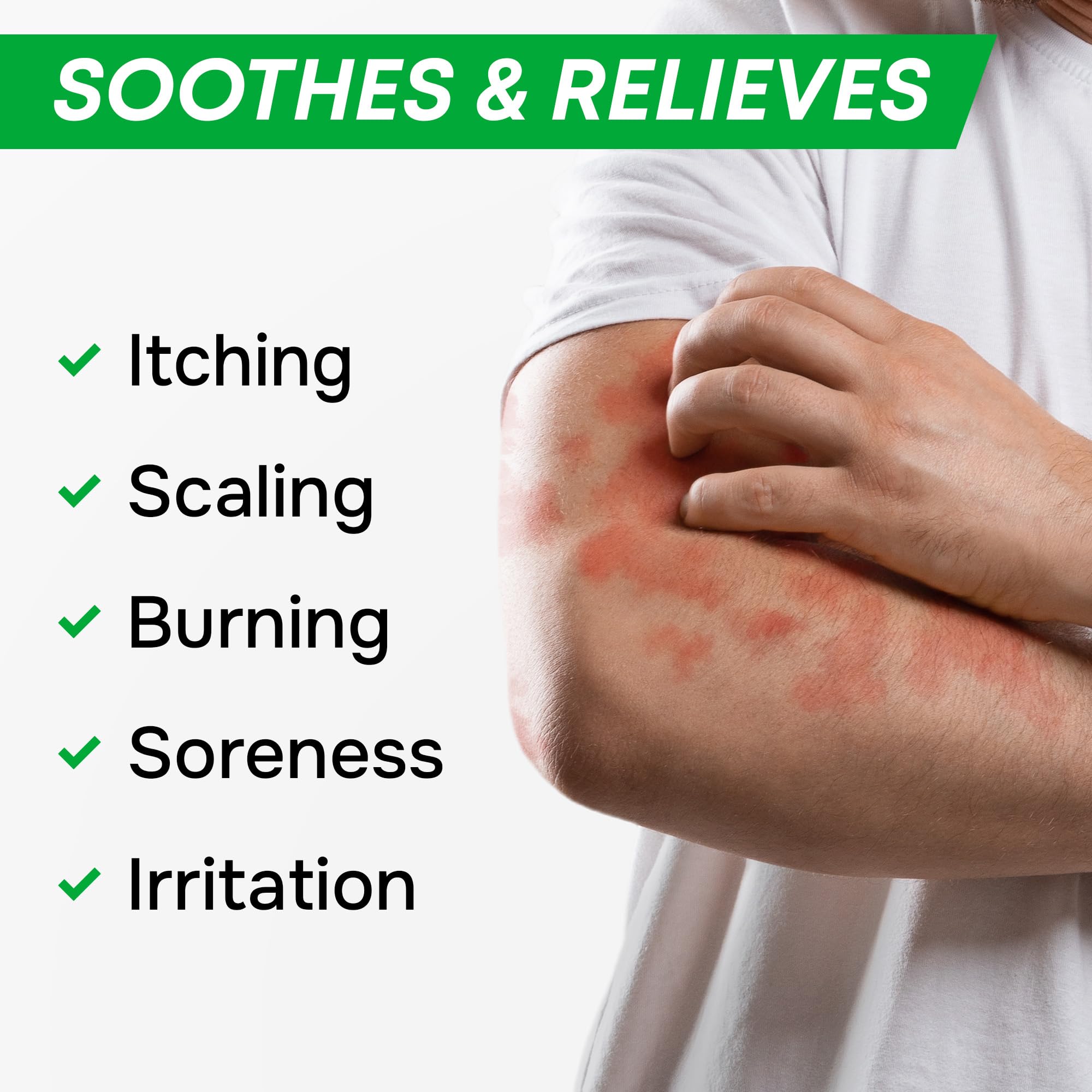 SimplyVital Ringworm care application shows soothing cream on affected skin