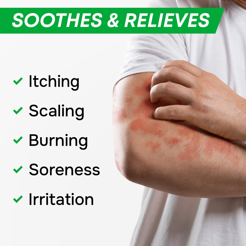 SimplyVital Ringworm care application shows soothing cream on affected skin
