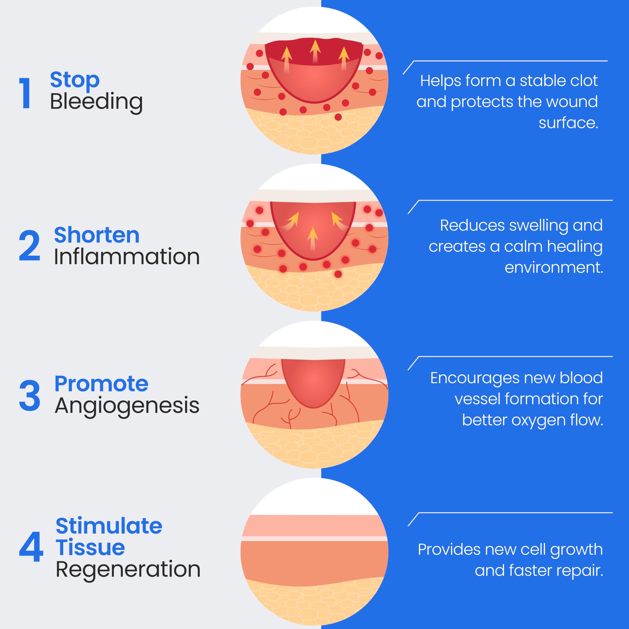 Simpurity conformable collagen dressing adapts to irregular wound contours.