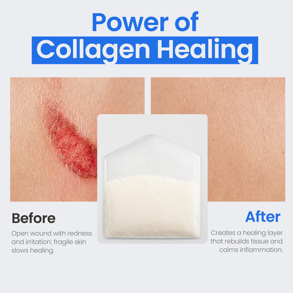 Simpurity collagen powder designed for complex wounds and irregular sites.