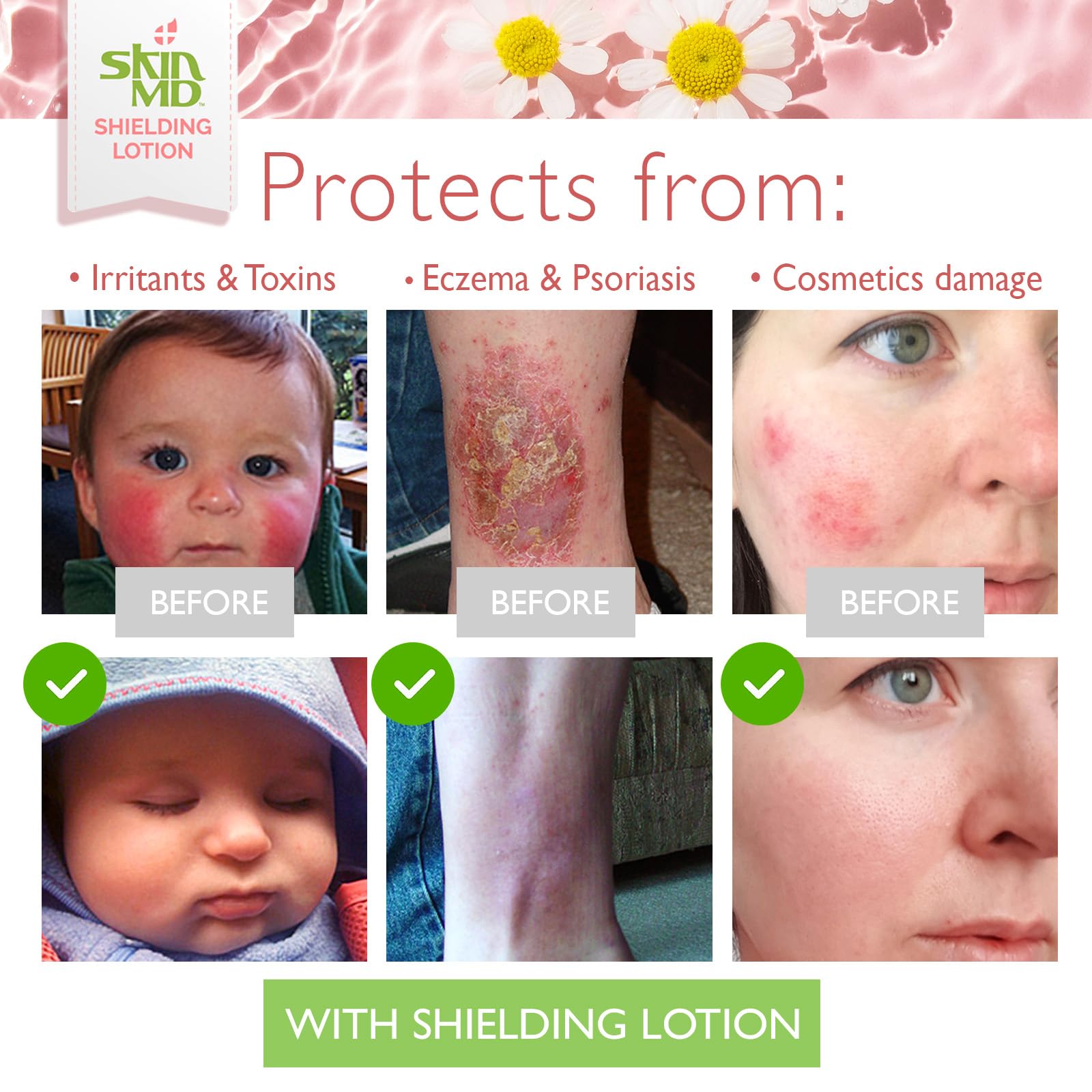 16oz Skin MD Shielding Lotion packaging suitable for daily moisturization