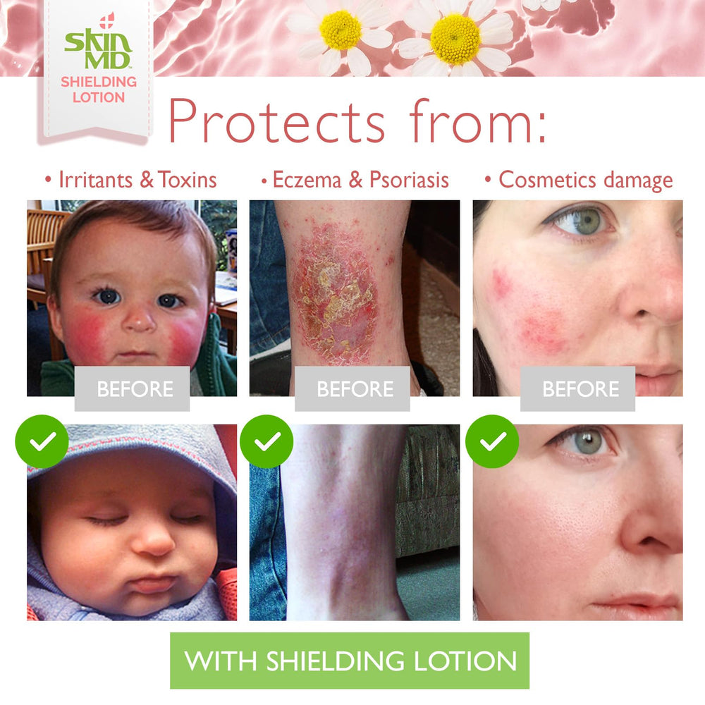 16oz Skin MD Shielding Lotion packaging suitable for daily moisturization