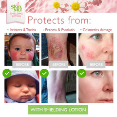 16oz Skin MD Shielding Lotion packaging suitable for daily moisturization