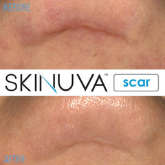 Cream applied on skin showing smooth, even distribution.