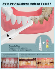 Smile-Aid Tooth Polisher with LED light enabling precise stain removal.