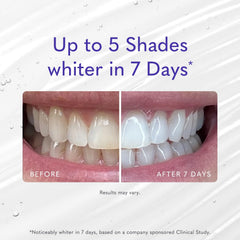 Smileactives rapid whitening visual shows fast results from seven days.