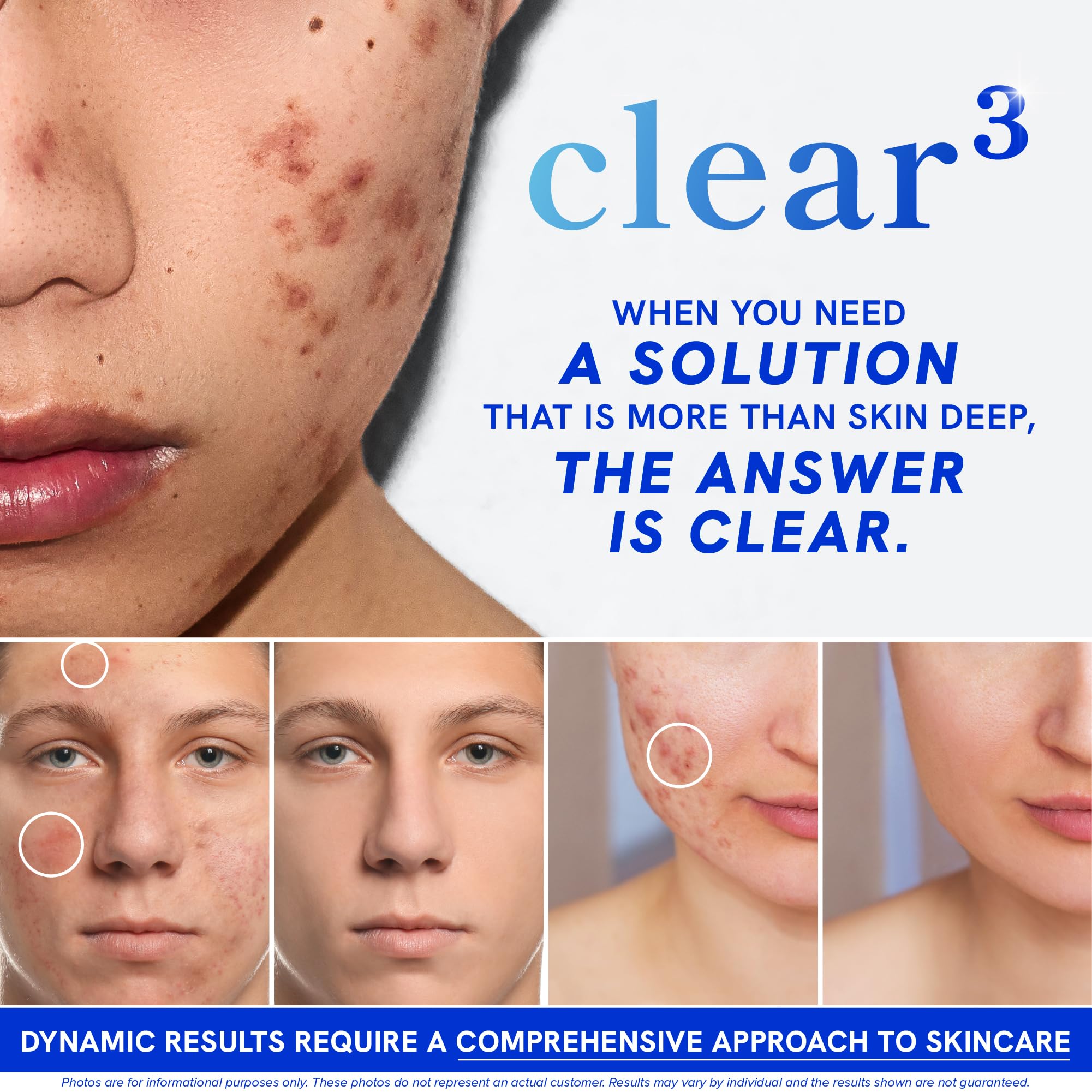 SMNutrition Clear Skin bottle back label describing zinc and niacinamide for skin hydration.