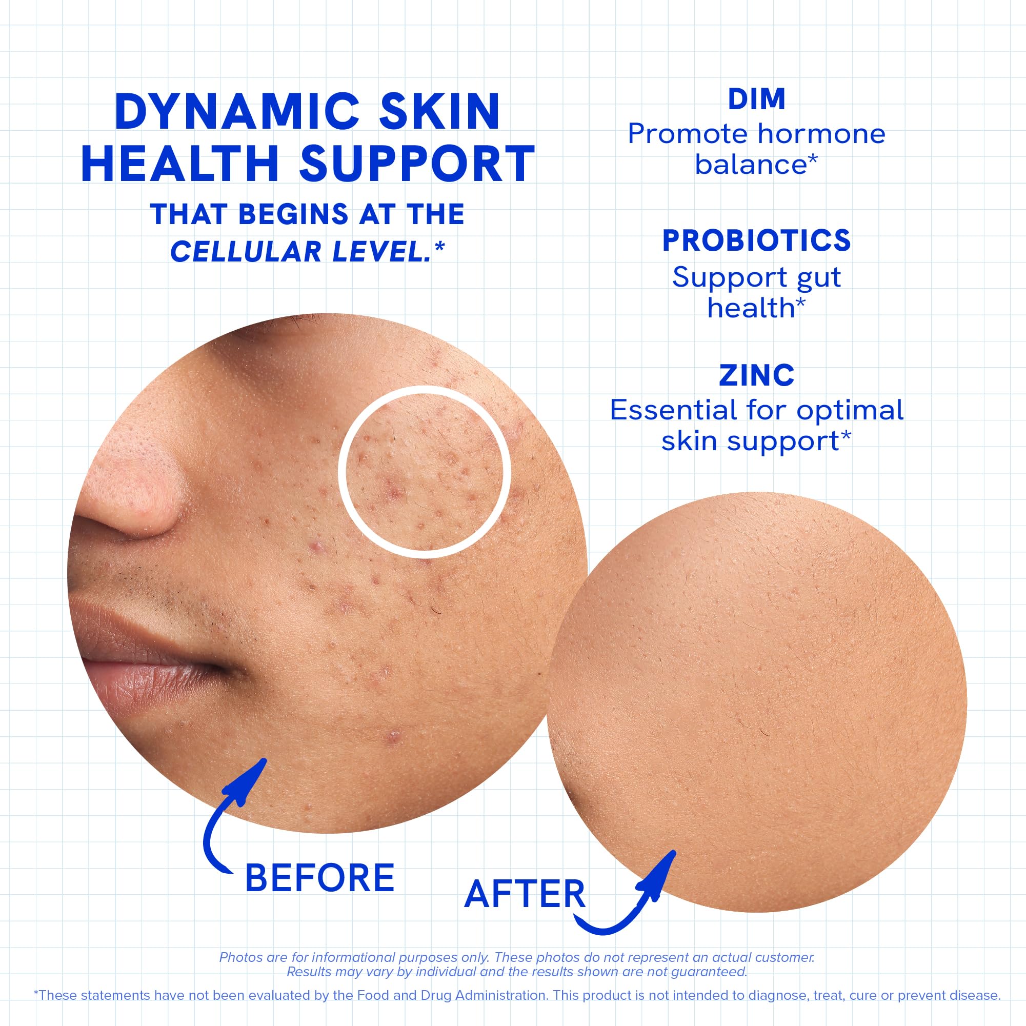 SMNutrition Clear Skin capsules pouring to illustrate easy daily intake.
