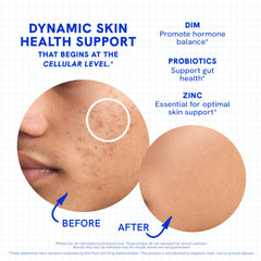 SMNutrition Clear Skin capsules pouring to illustrate easy daily intake.