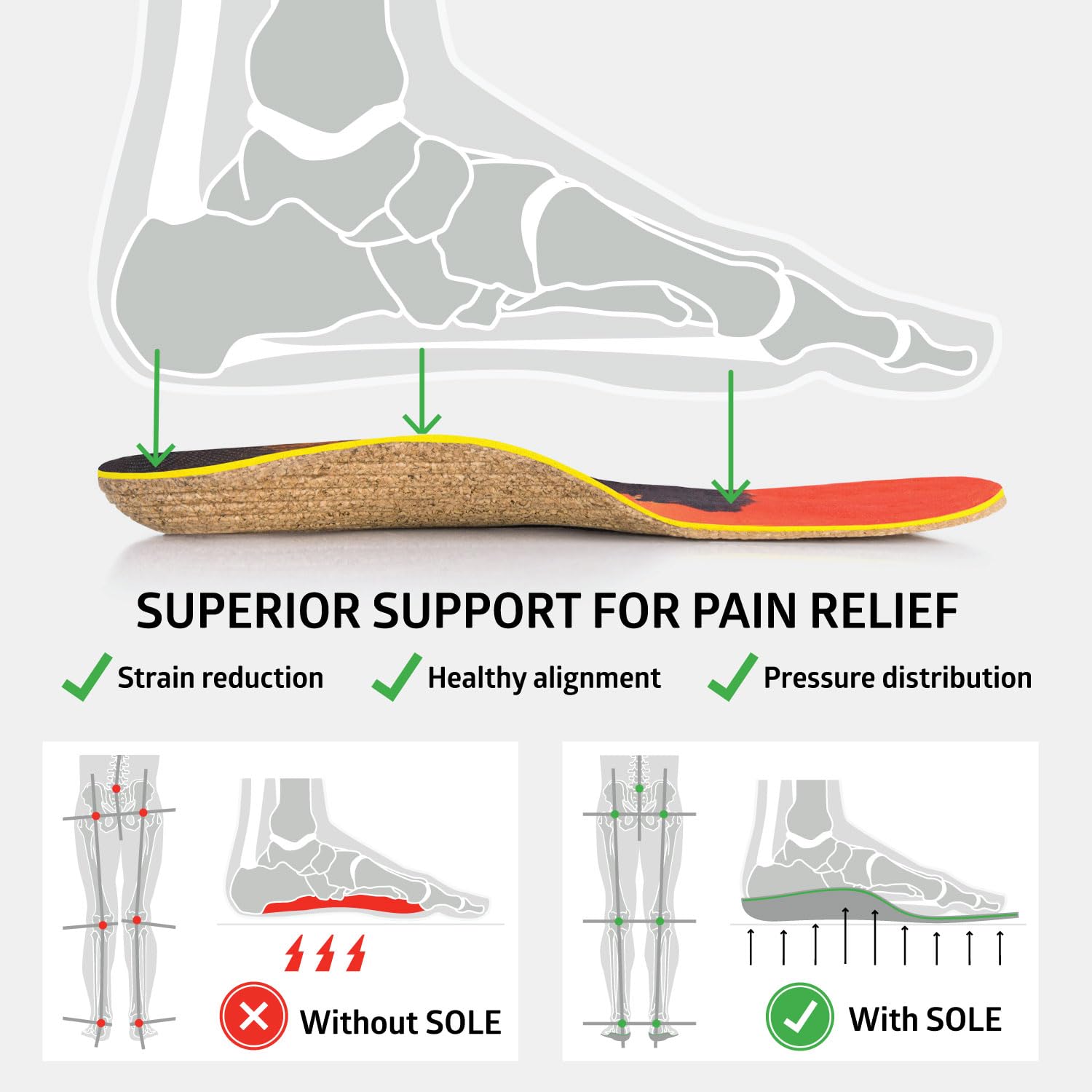 SOLE customizable-fit insoles let you heat-mold to your arch for personalized support.