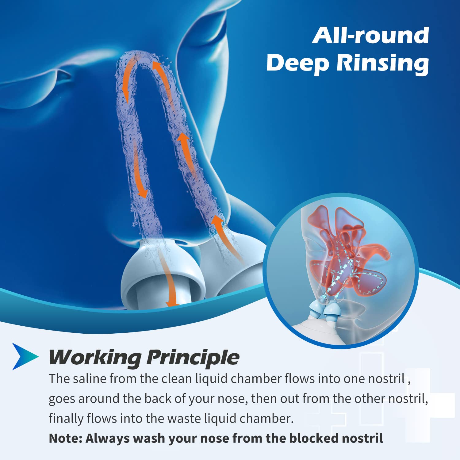 Sonmol pressure safety valve ensures controlled flushing during congestion