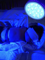 Stickfrease baby eye patch accessory protects eyes during blue light therapy
