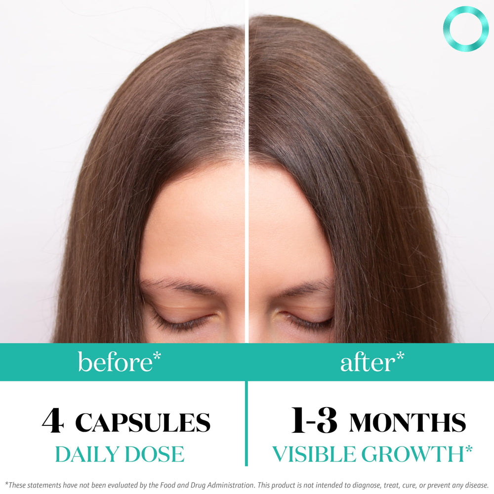 Close-up of Superfood MD balance hair growth label highlighting a 26-ingredient formula.