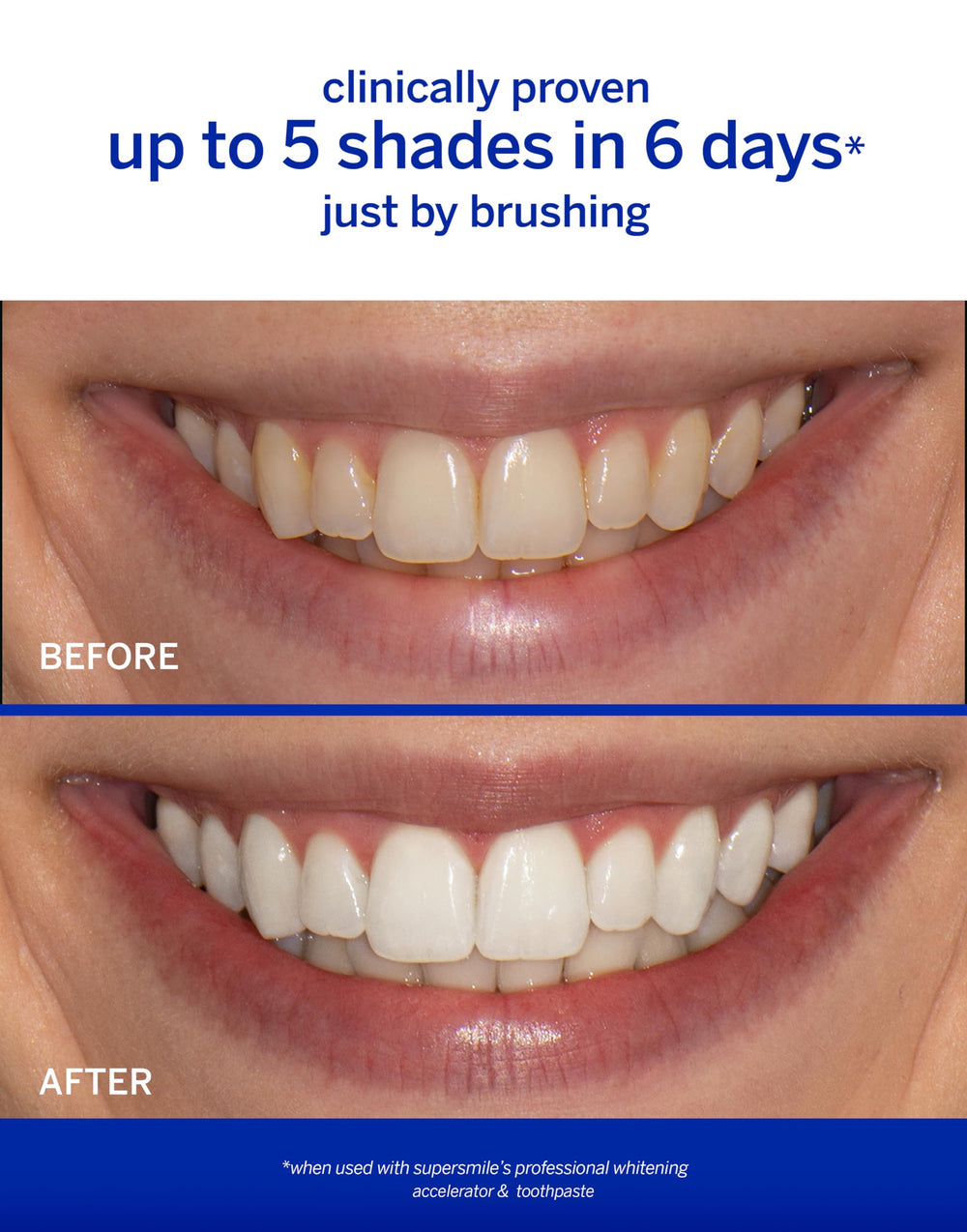 Supersmile pre rinse icy finish preps enamel for whitening