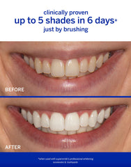 Supersmile Accelerator gel-application shows targeted whitening action