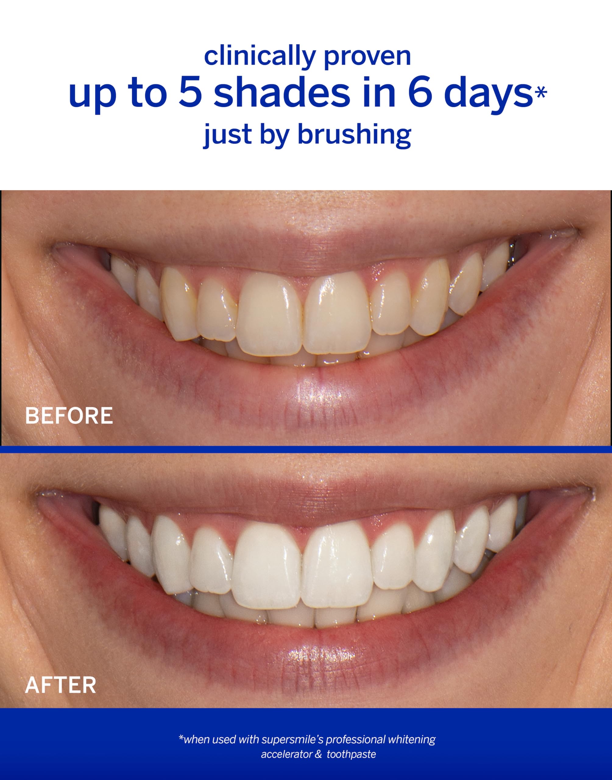Supersmile Wild Mint whitening accelerator close-up for faster shade whitening