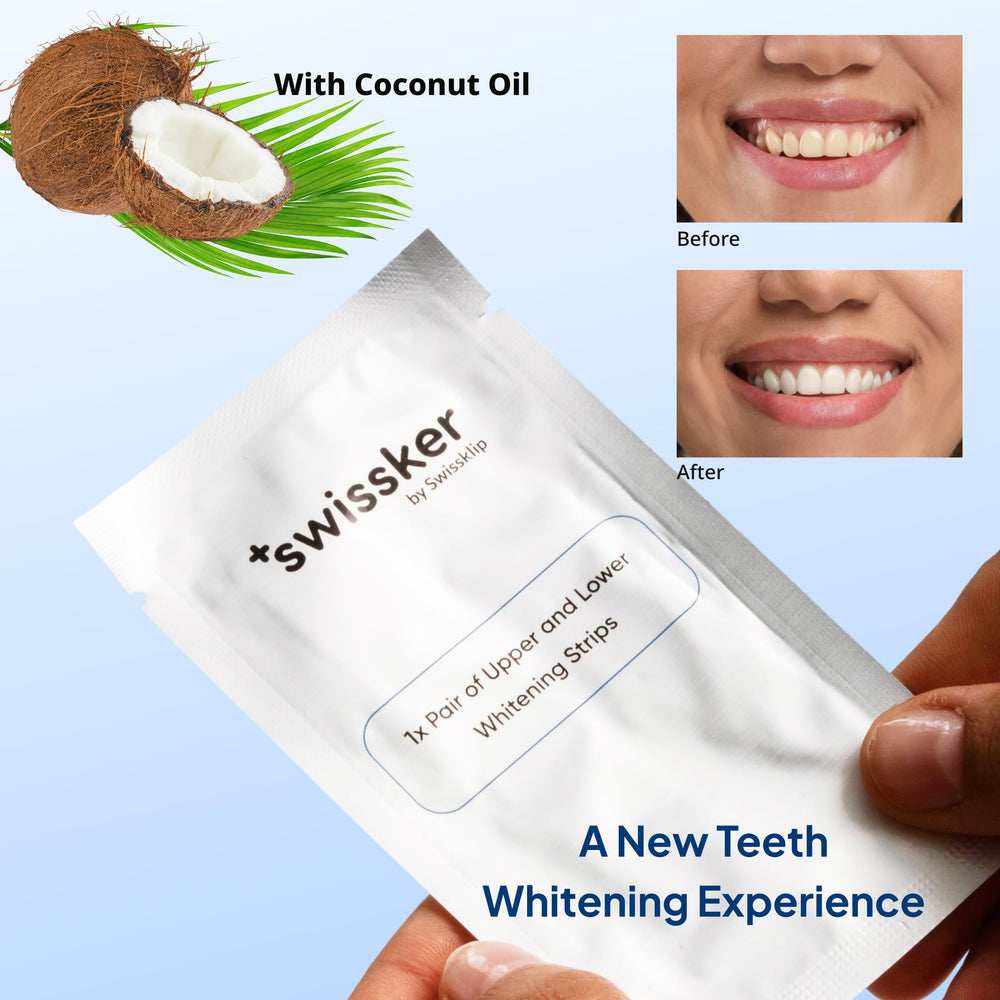 Close-up of ShineStrips adhered to teeth with comfortable fit