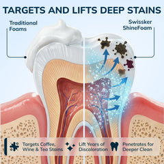 Aligners and retainers cleaning plus whitening in one daily foam routine.