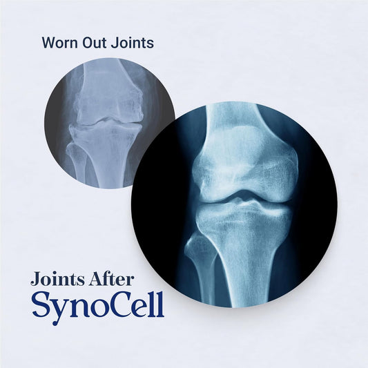 Synocell capsules close-up highlighting convenient daily capsules for joints.