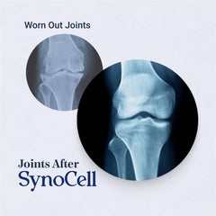 Synocell ingredient icons showing glucosamine, chondroitin, boswellia, quercetin, MSM.
