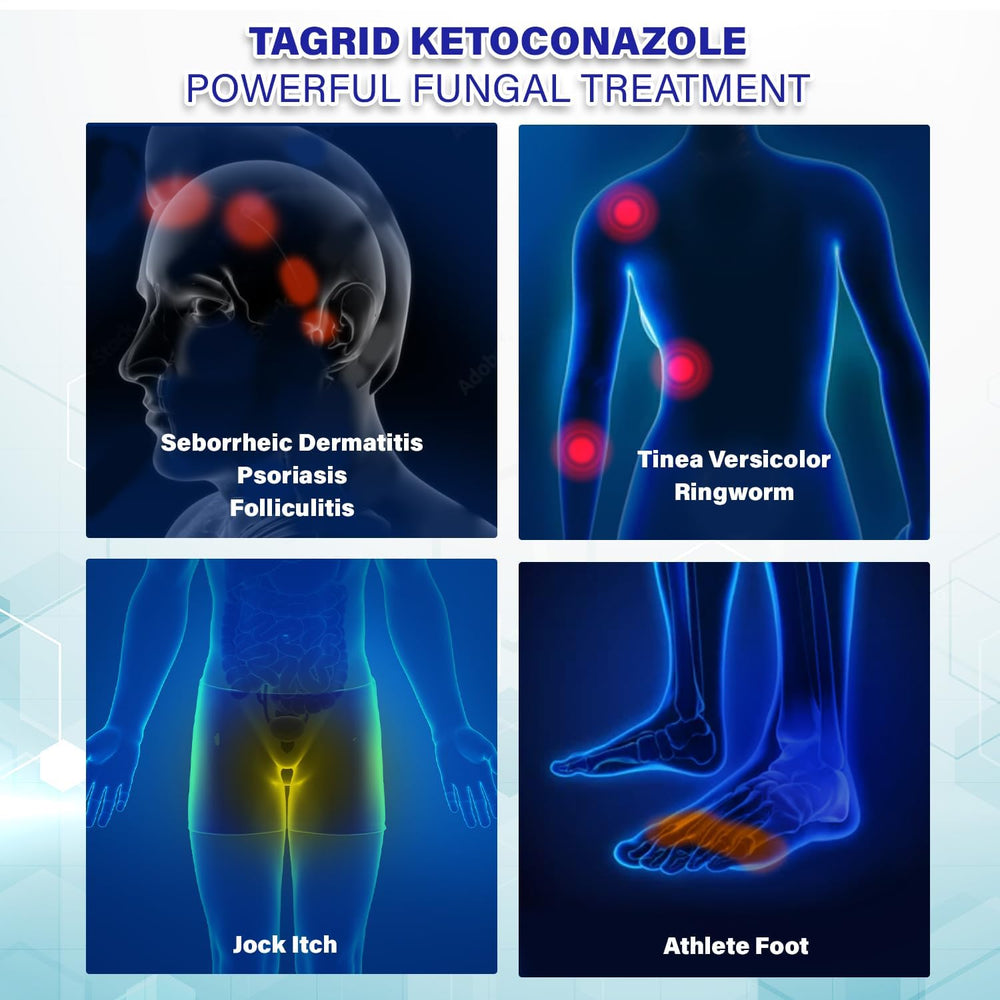 TAGRID Antifungal Cream | Maximum Strength Ringworm & Tinea Versicolor ...