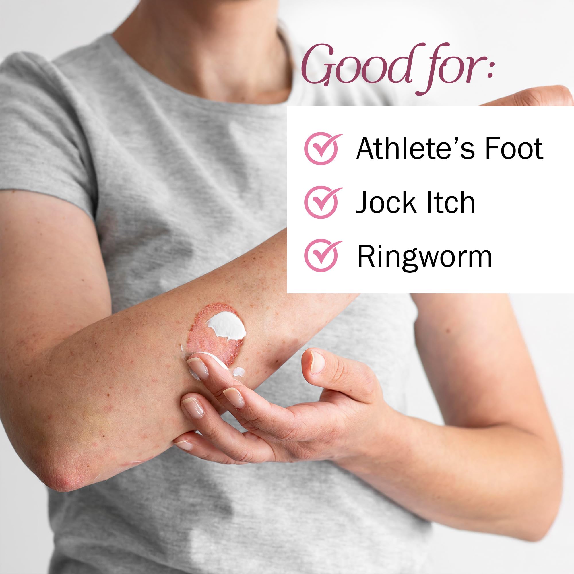 TenderGentle Clotrimazole cream application on foot demonstrates use against athletes' foot