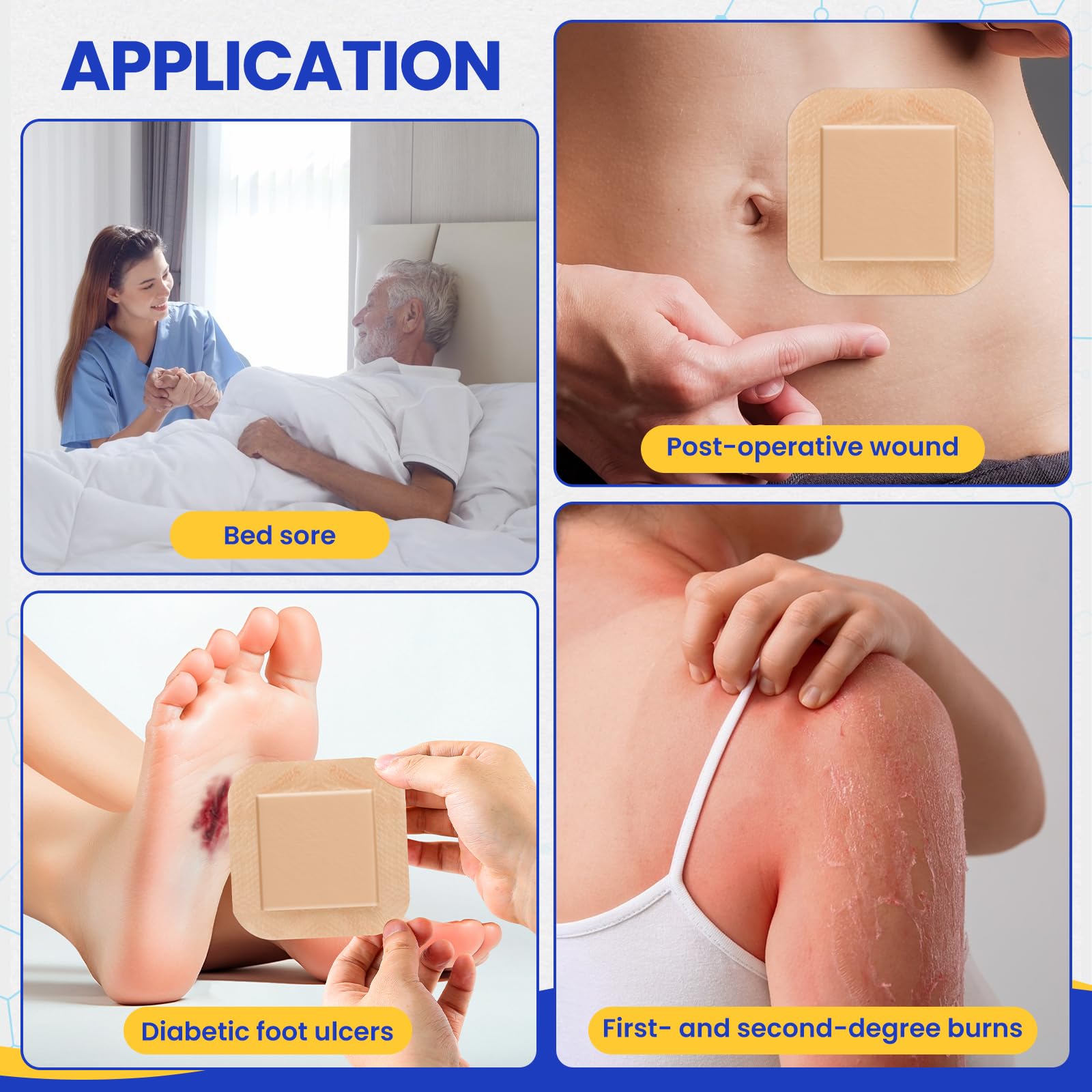 TENKAIWICK 40-piece box of silicone foam dressings for daily care