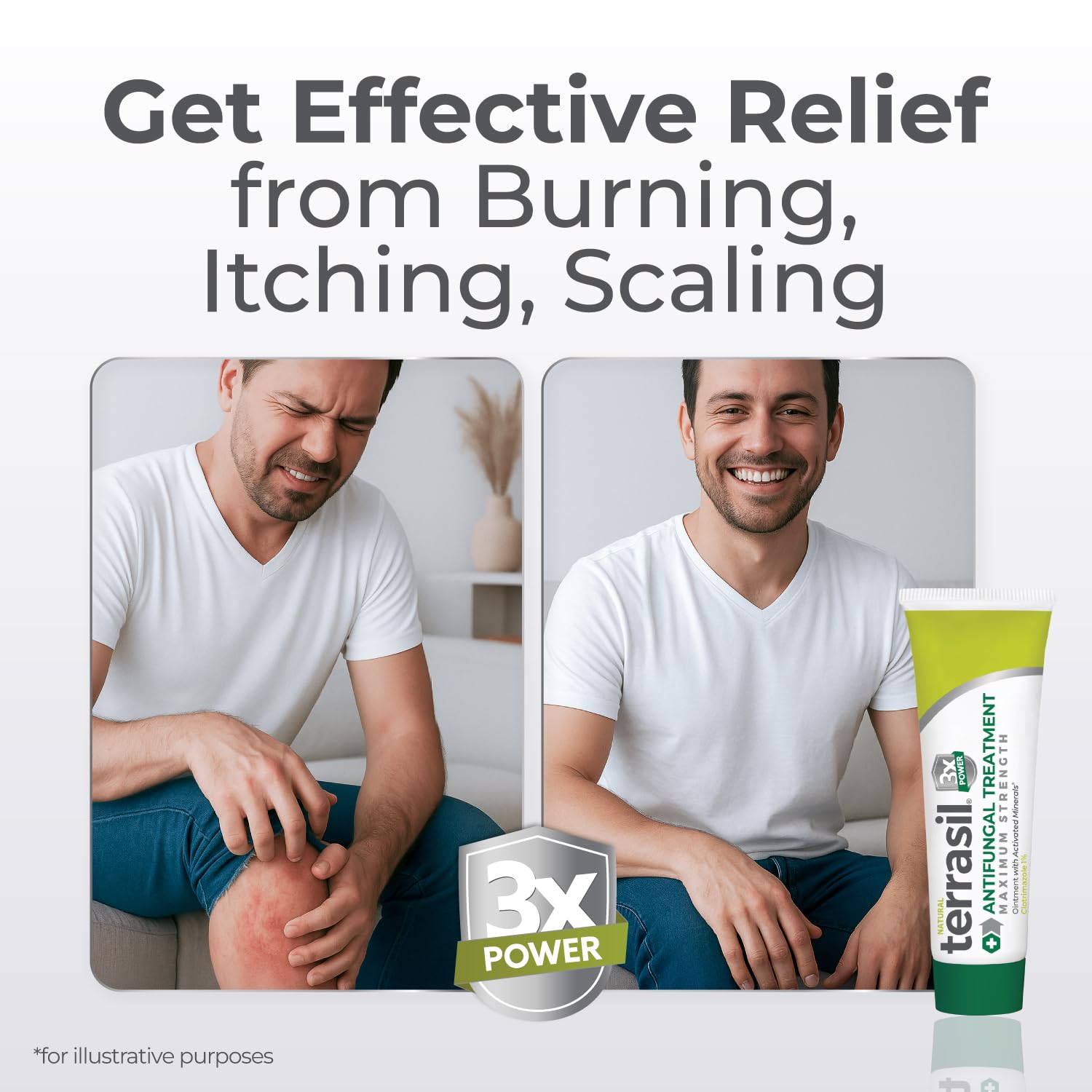 Terrasil Clotrimazole cream application on body highlights flexible use