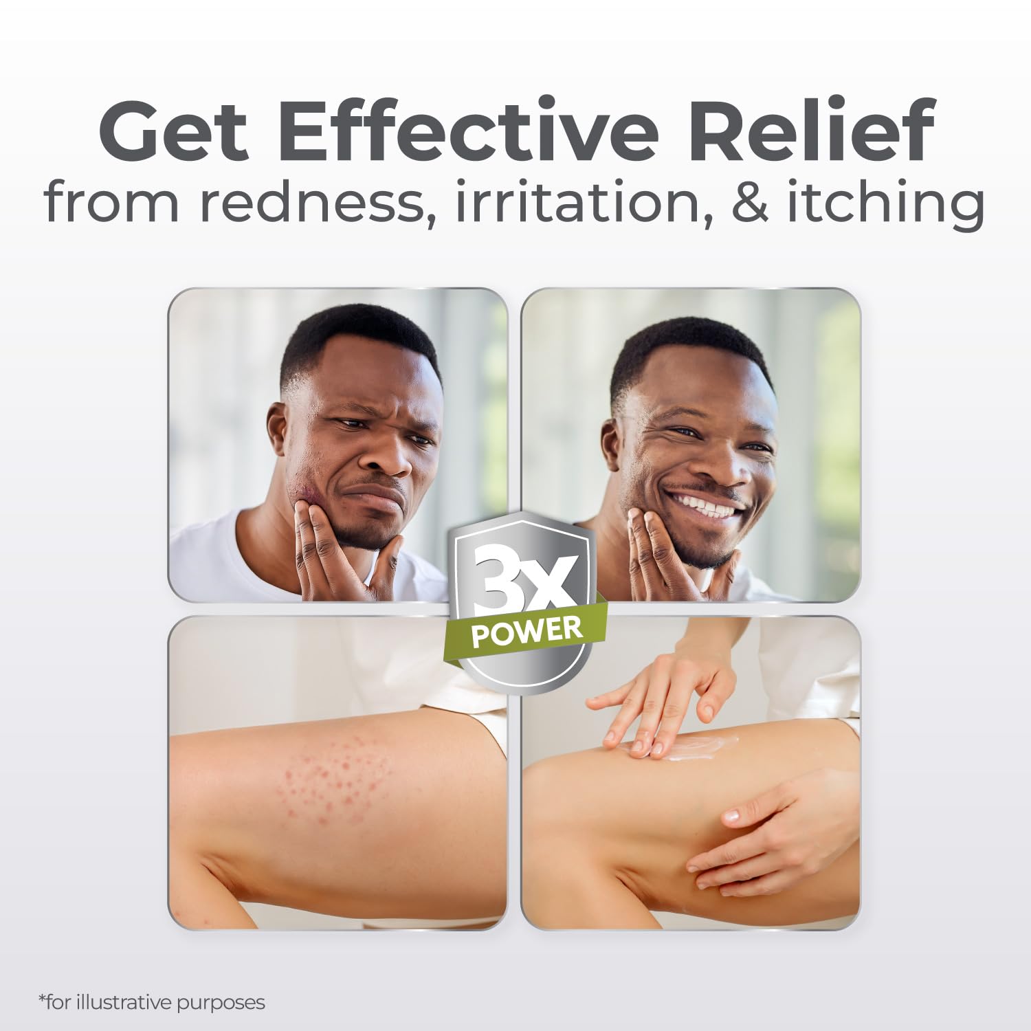 Terrasil Folliculitis Cream label detail highlights 1% clotrimazole