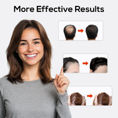 TMOSSO Laser Cap portable design supports flexible use at home or travel.