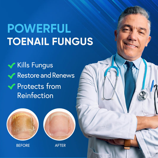 Tobcharm 25 percent undecylenic acid bottle for targeted nail care.