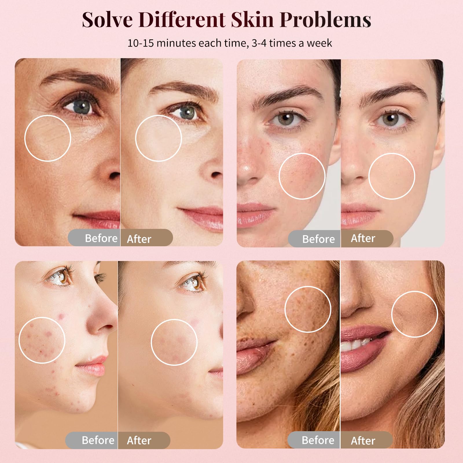 TOFEKIA red and near-infrared mode for wrinkle-friendly sessions at home.