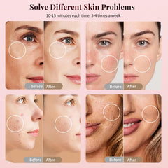 TOFEKIA red and near-infrared mode for wrinkle-friendly sessions at home.