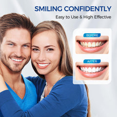 Toos Show smile after use appears brighter and more confident