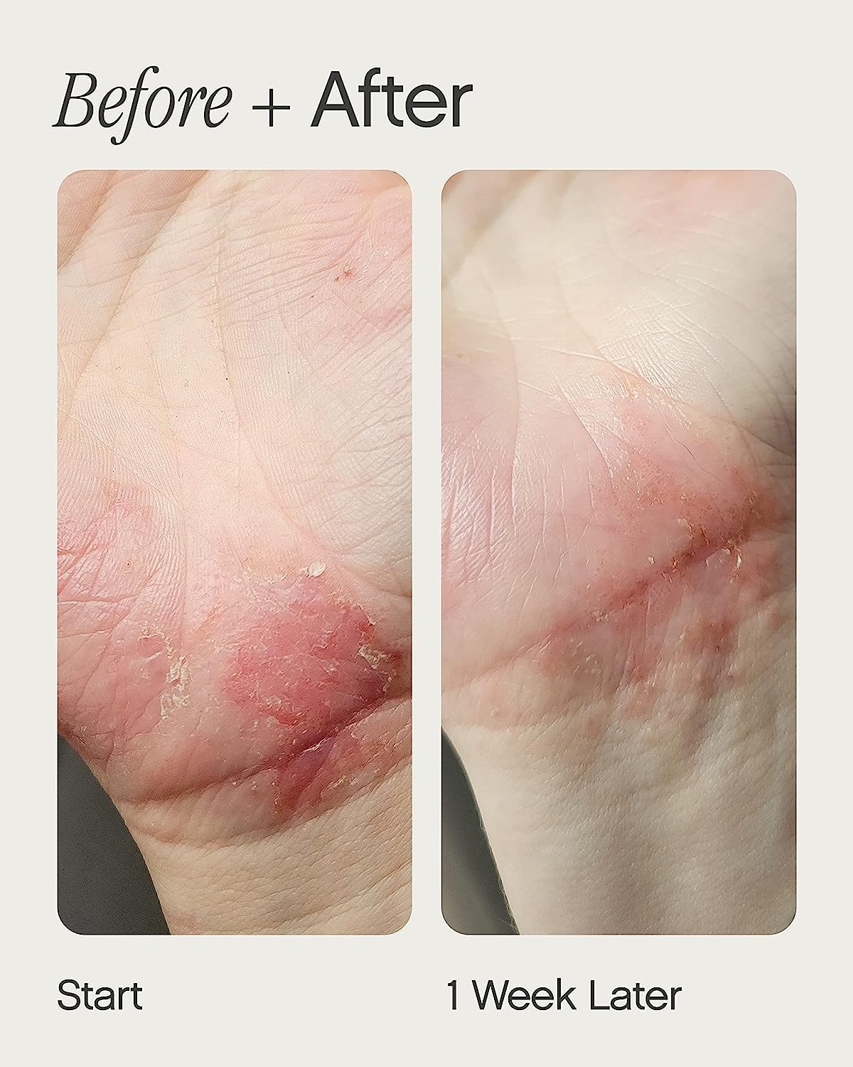 Topicals Like Butter texture on skin illustrating deep non-greasy hydration.