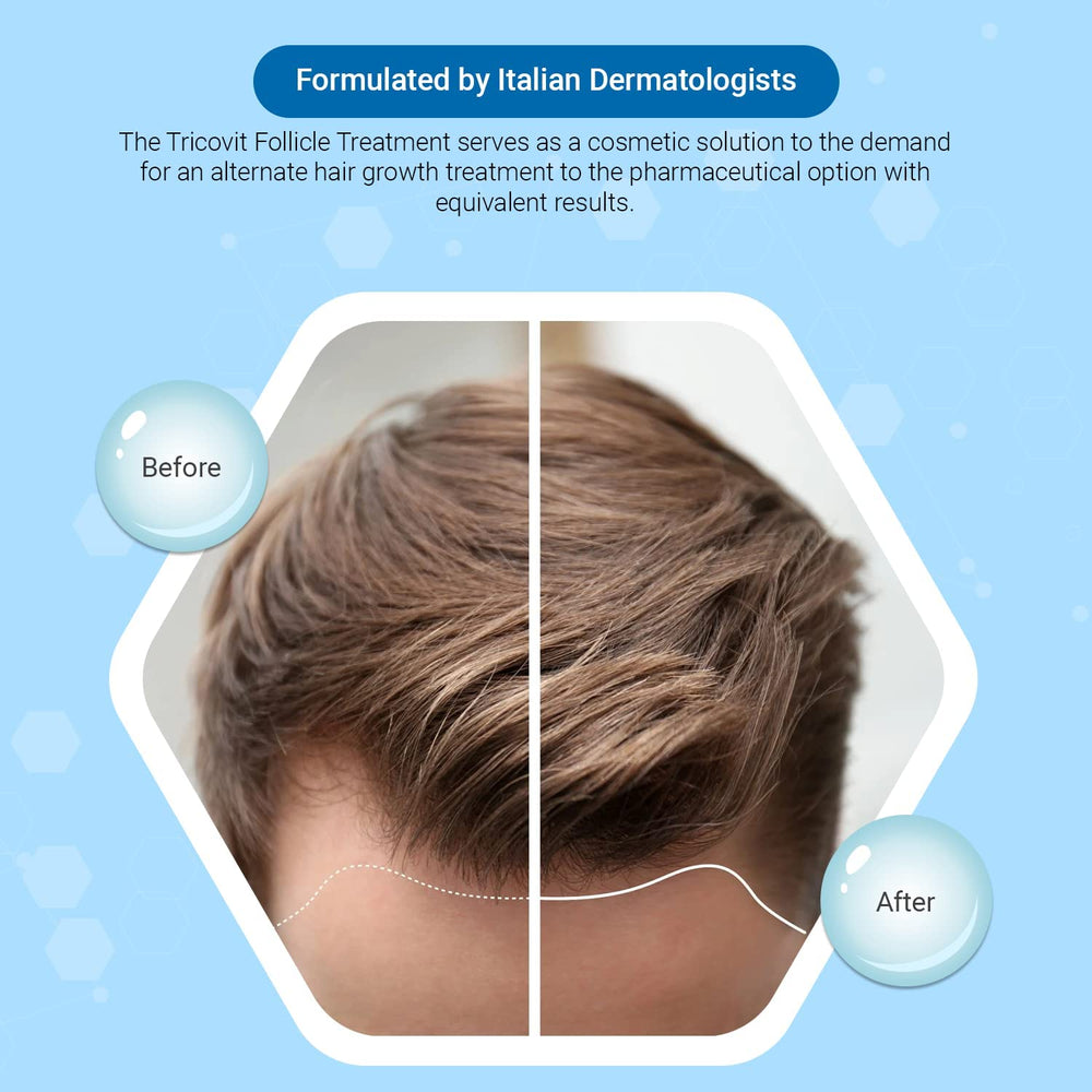 Tricovit Tricocaps rosemary extract highlight from plant-based formula.